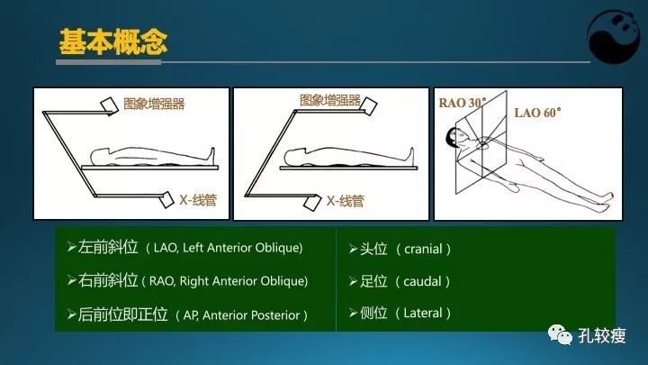 步步为营掌握冠状动脉造影【一】：解剖-体位-安全法则