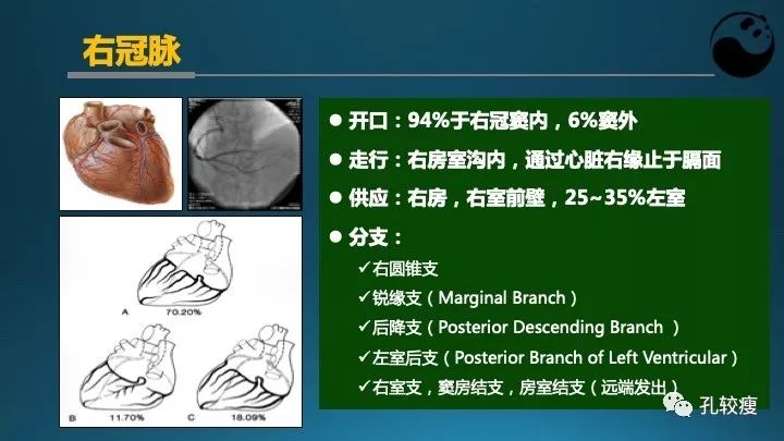 步步为营掌握冠状动脉造影【一】：解剖-体位-安全法则