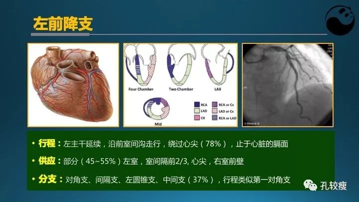 步步为营掌握冠状动脉造影【一】：解剖-体位-安全法则