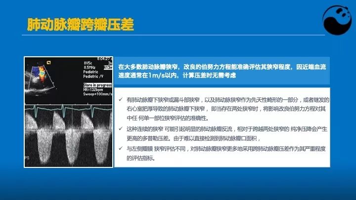 如何使用超声心动图引导瓣膜病介入治疗？