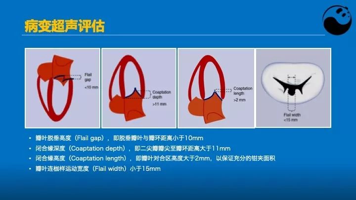 如何使用超声心动图引导瓣膜病介入治疗？