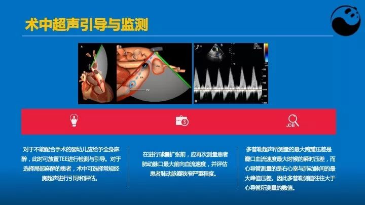 如何使用超声心动图引导瓣膜病介入治疗？