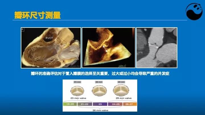 如何使用超声心动图引导瓣膜病介入治疗？