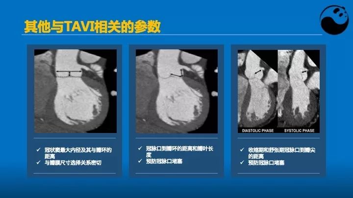 如何使用超声心动图引导瓣膜病介入治疗？