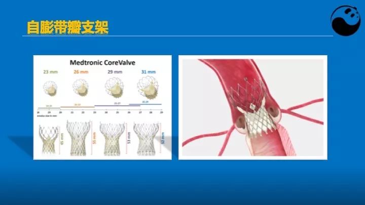 如何使用超声心动图引导瓣膜病介入治疗？