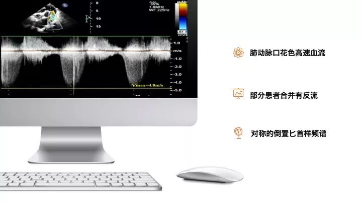 如何使用超声心动图引导瓣膜病介入治疗？