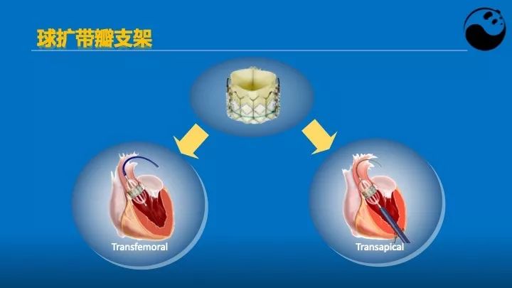 如何使用超声心动图引导瓣膜病介入治疗？