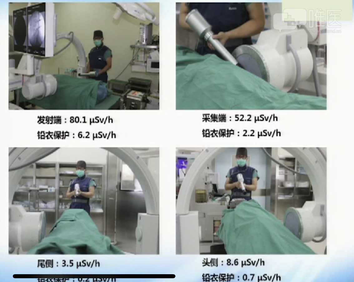 拿什么拯救你：长时间暴露在X射线下的骨科医生！