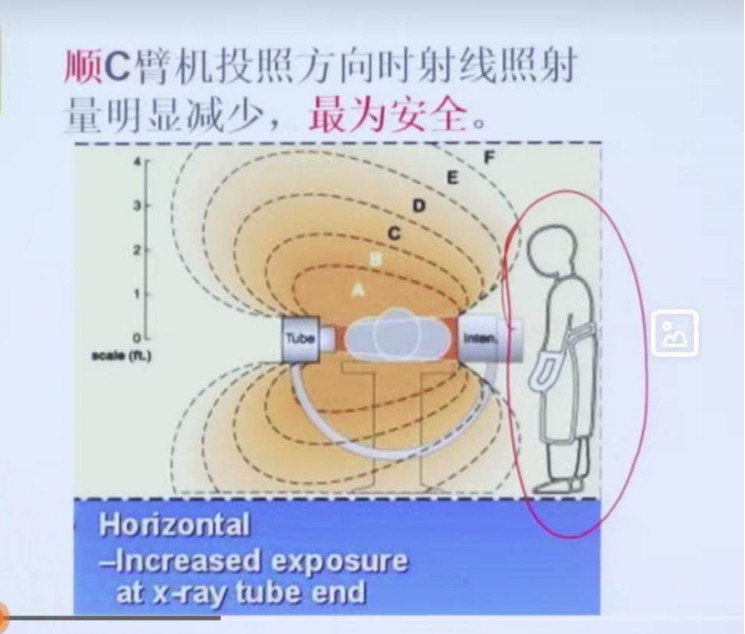 拿什么拯救你：长时间暴露在X射线下的骨科医生！