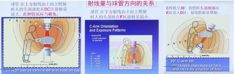 拿什么拯救你：长时间暴露在X射线下的骨科医生！