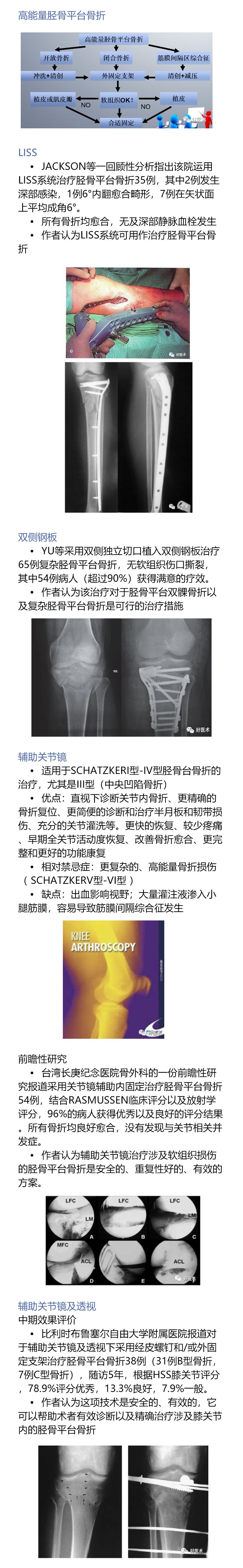 一目了然！5张图教你做好胫骨平台骨折！