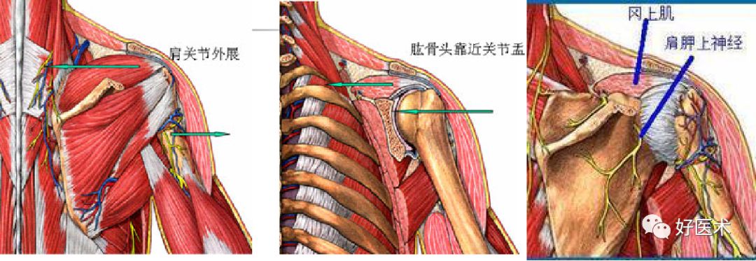 肩周炎7大要点详解，看完我就收藏了！