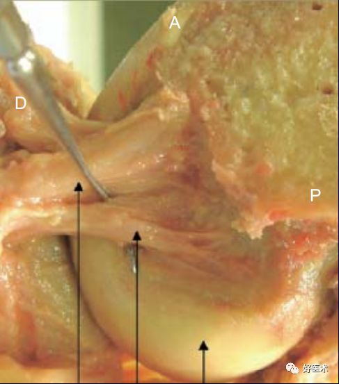 膝关节解剖高清图解，基础必备！