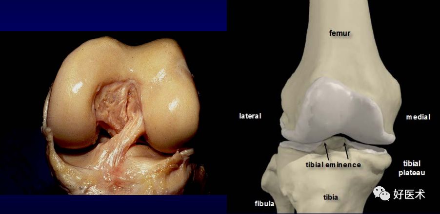 膝关节解剖高清图解，基础必备！
