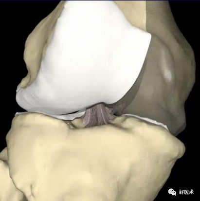 膝关节解剖高清图解，基础必备！
