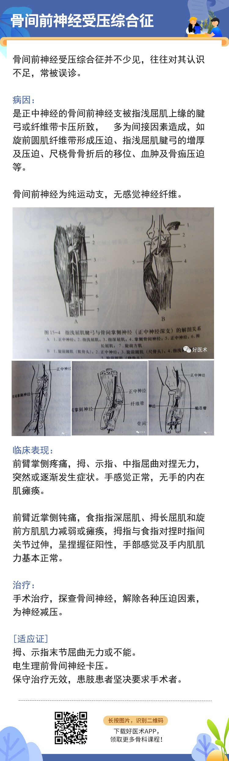 骨科常见周围神经卡压综合征，你都认识吗？