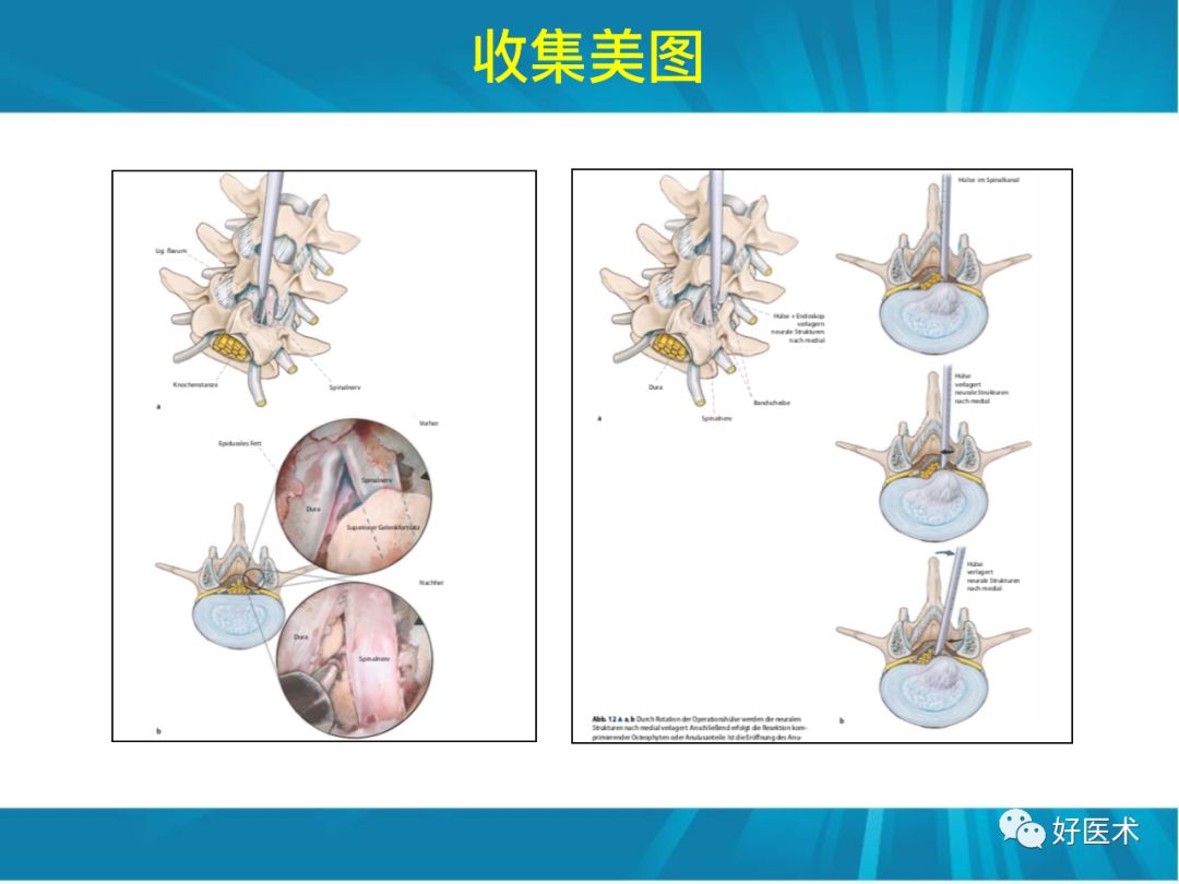 骨林秘籍：年轻骨科医生的成长之道！