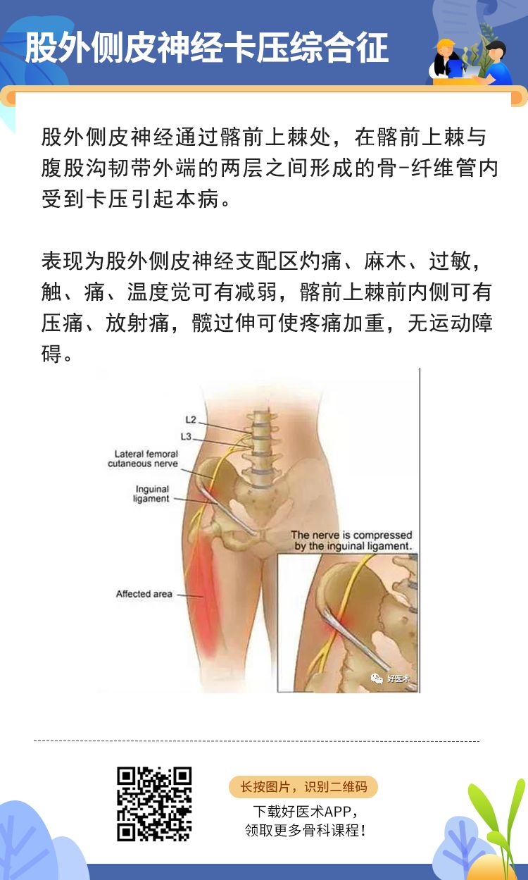 骨科常见周围神经卡压综合征，你都认识吗？