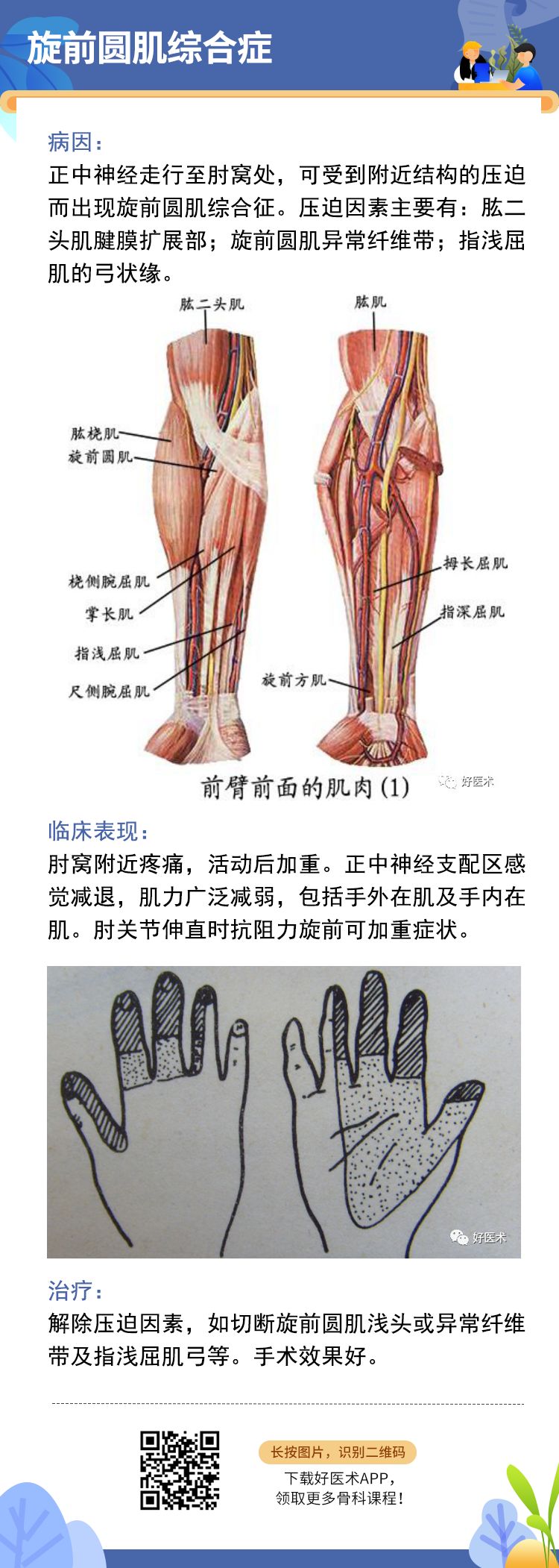 骨科常见周围神经卡压综合征，你都认识吗？