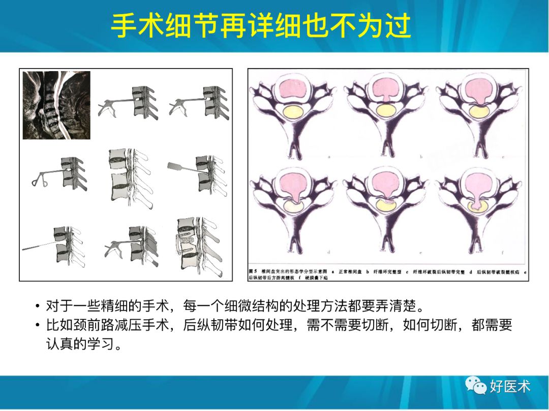 骨林秘籍：年轻骨科医生的成长之道！