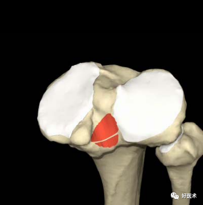 膝关节解剖高清图解，基础必备！