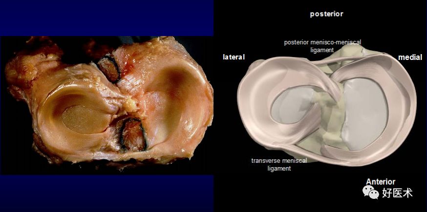 膝关节解剖高清图解，基础必备！