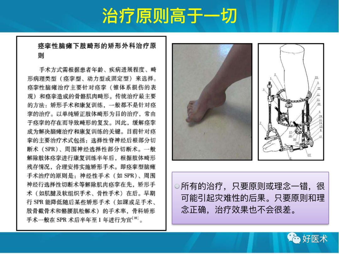 骨林秘籍：年轻骨科医生的成长之道！