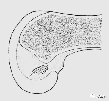 膝关节解剖高清图解，基础必备！