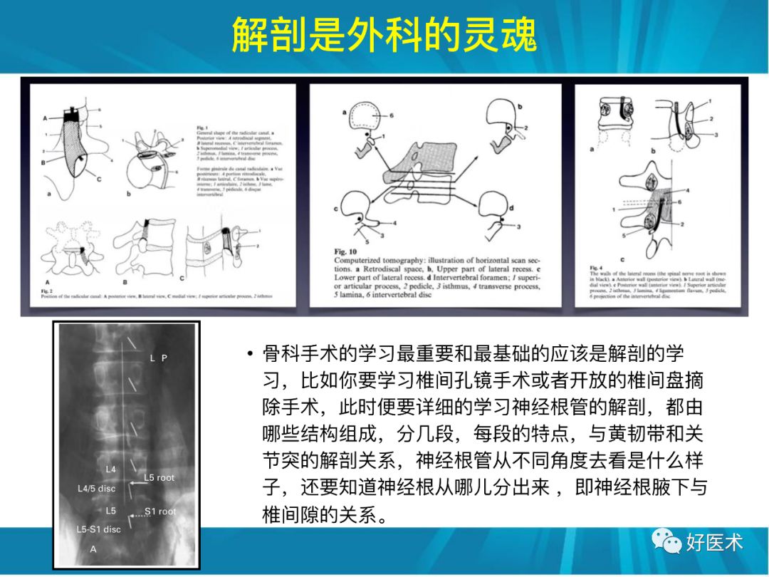 骨林秘籍：年轻骨科医生的成长之道！