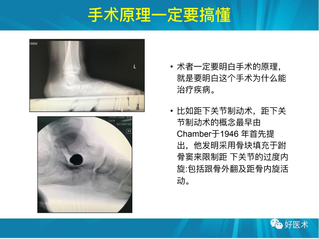 骨林秘籍：年轻骨科医生的成长之道！