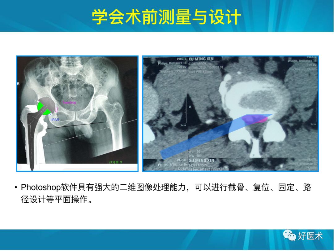 骨林秘籍：年轻骨科医生的成长之道！