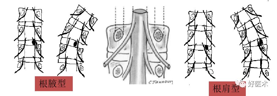 10分钟带您系统学习：腰椎间盘突出症！