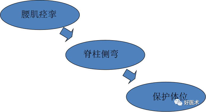 10分钟带您系统学习：腰椎间盘突出症！