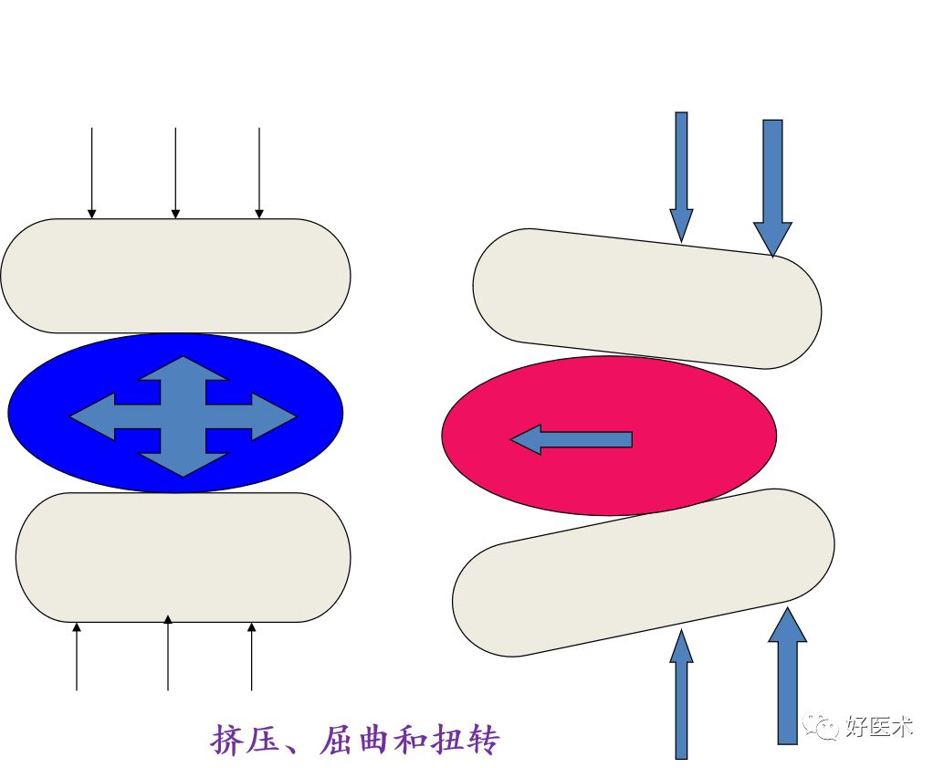 10分钟带您系统学习：腰椎间盘突出症！