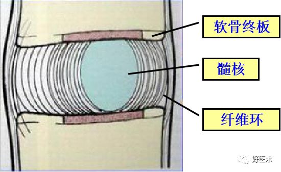 10分钟带您系统学习：腰椎间盘突出症！