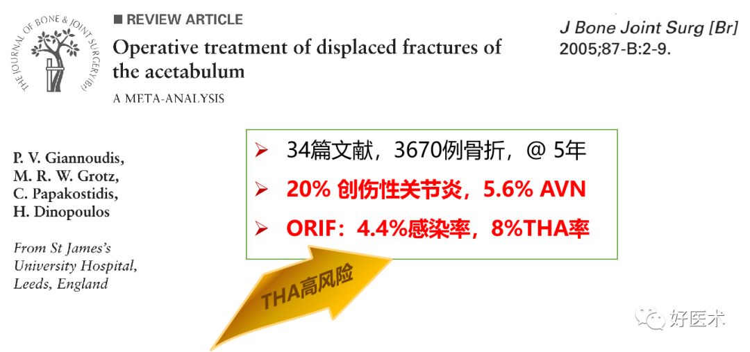 面对复杂初次髋关节置换，我们应如何应对？