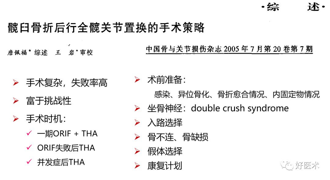 面对复杂初次髋关节置换，我们应如何应对？