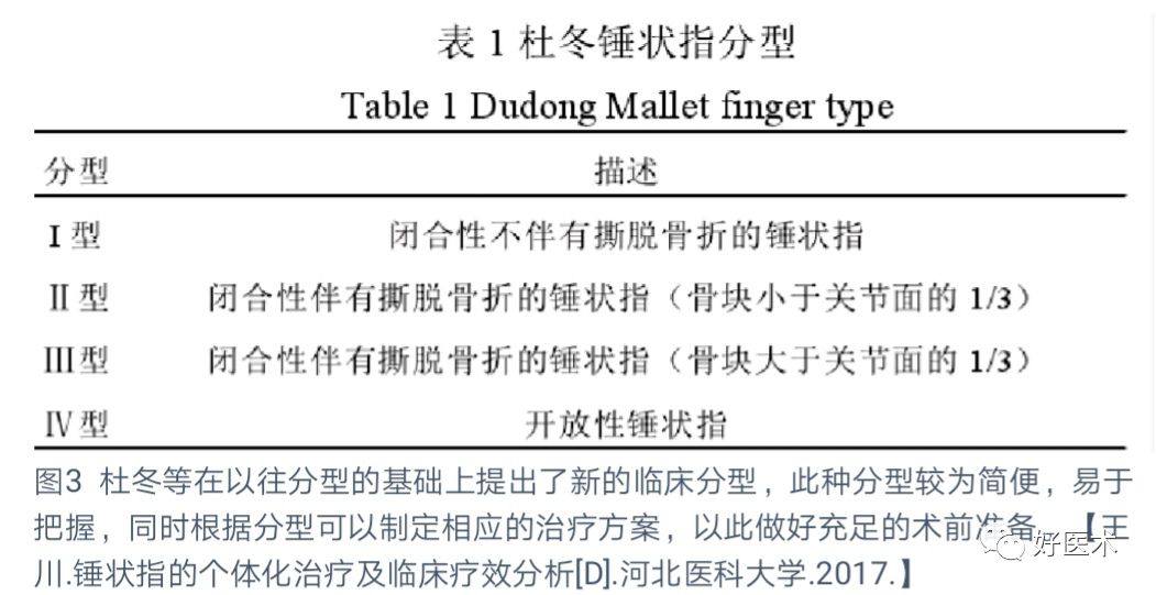 详解治疗锤状指的7种手术方法，你都掌握了吗？