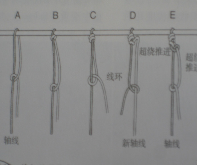 最全肩袖损伤诊断与治疗关键汇总，内附超详细检查手段！