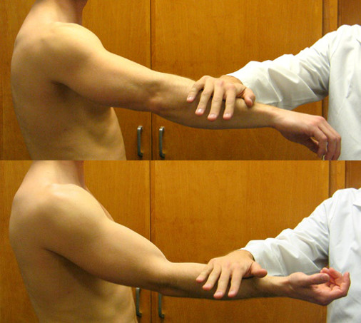 最全肩袖损伤诊断与治疗关键汇总，内附超详细检查手段！