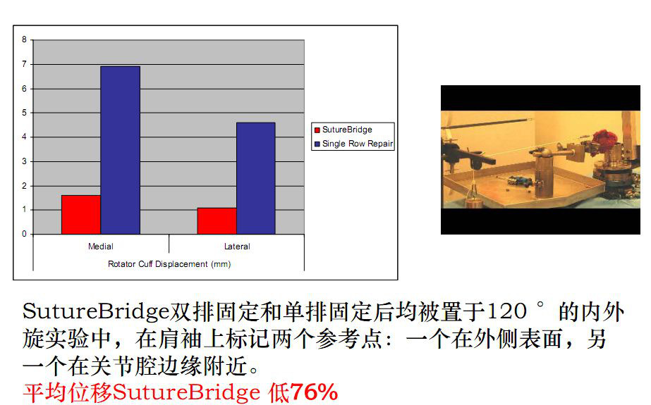 最全肩袖损伤诊断与治疗关键汇总，内附超详细检查手段！