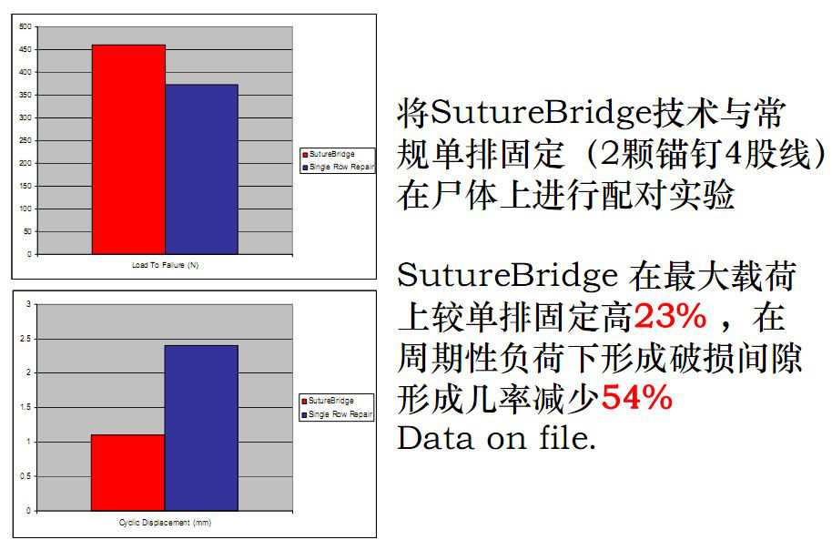 最全肩袖损伤诊断与治疗关键汇总，内附超详细检查手段！