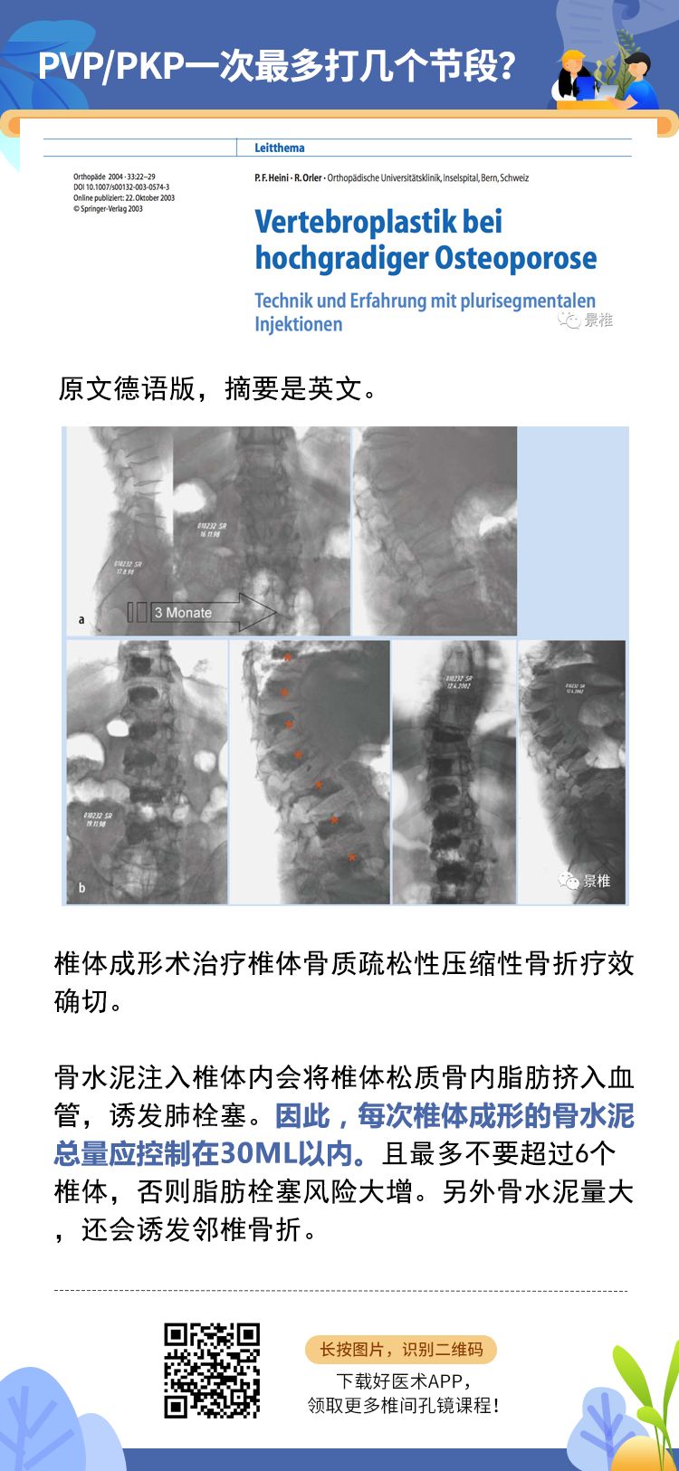 椎体成形术常见问题汇总，赶紧收藏备用！