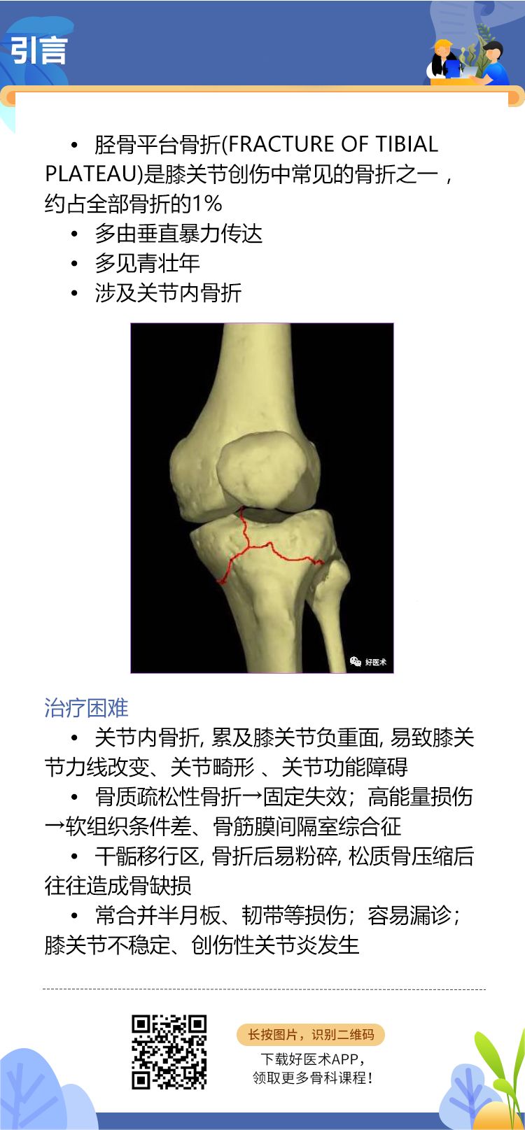 一目了然！5张图教你做好胫骨平台骨折！