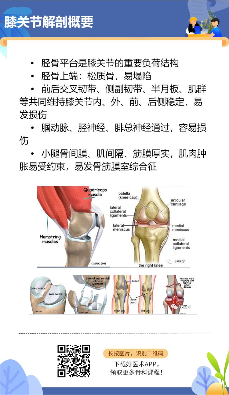 一目了然！5张图教你做好胫骨平台骨折！