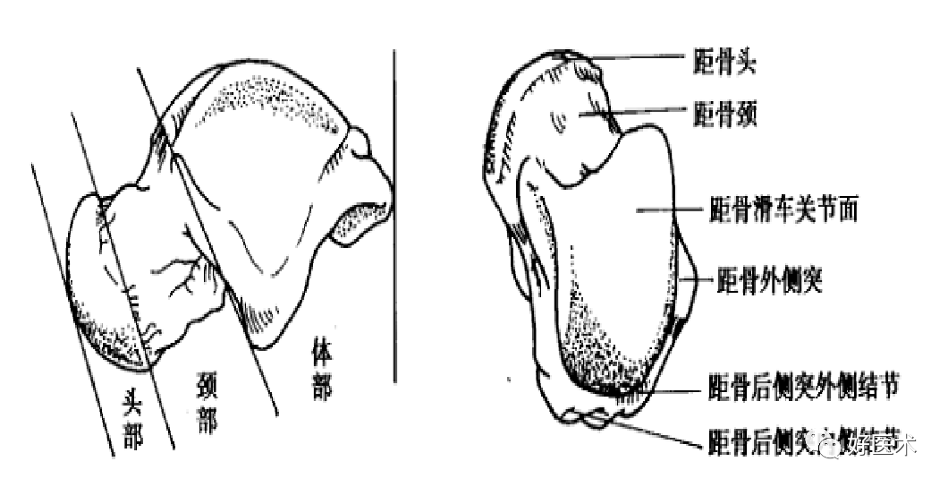 距骨骨折的治疗方法全解析，值得一看！