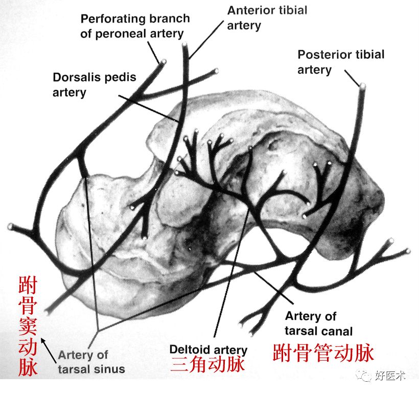 距骨骨折的治疗方法全解析，值得一看！