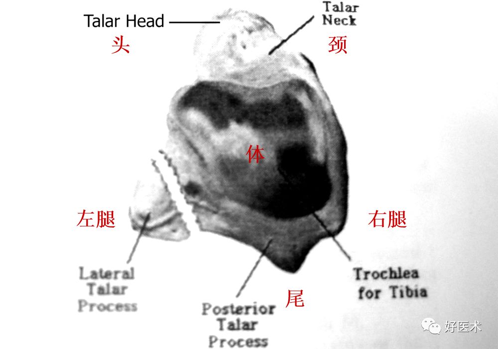 距骨骨折的治疗方法全解析，值得一看！