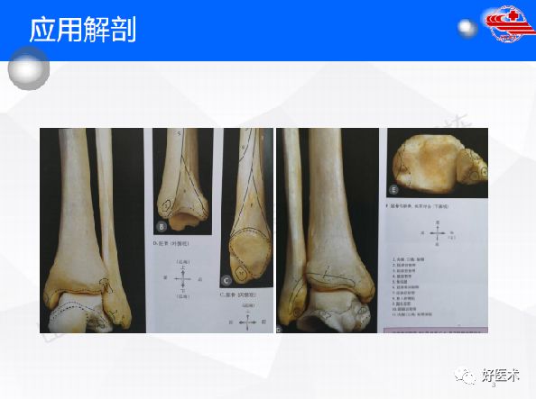 一文详解！踝关节的应用解剖及正常X线解读