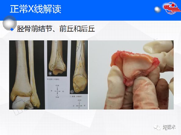 一文详解！踝关节的应用解剖及正常X线解读